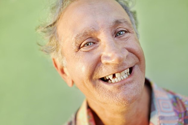 older man smiling with a missing tooth