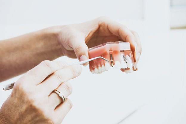 hand holding a model of dental implants