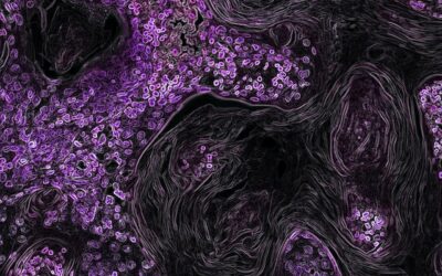 What are some subtle signs of oral cancer?