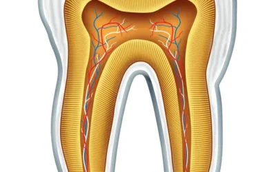 Watch Out for These 7 Signs of Cavities